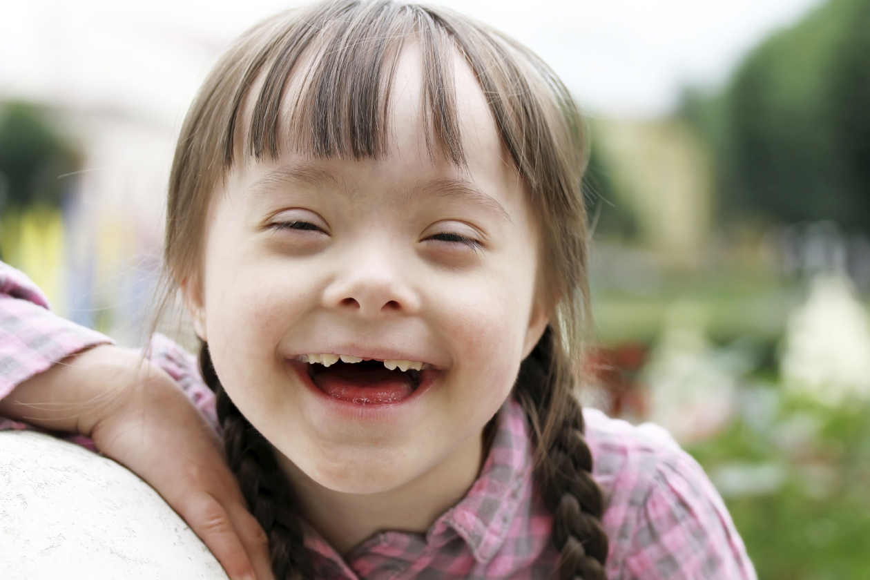 4-terapias-alternativas-para-el-sindrome-de-Down-1