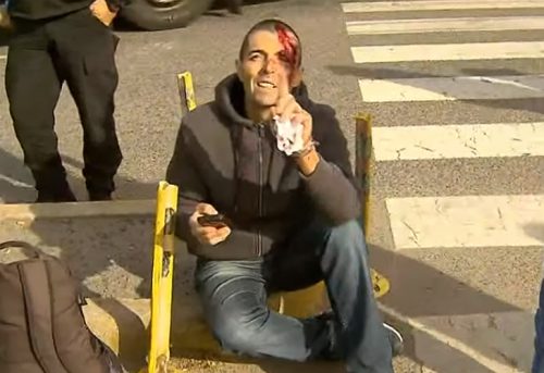 fiscal-delgado-tras-el-accidente