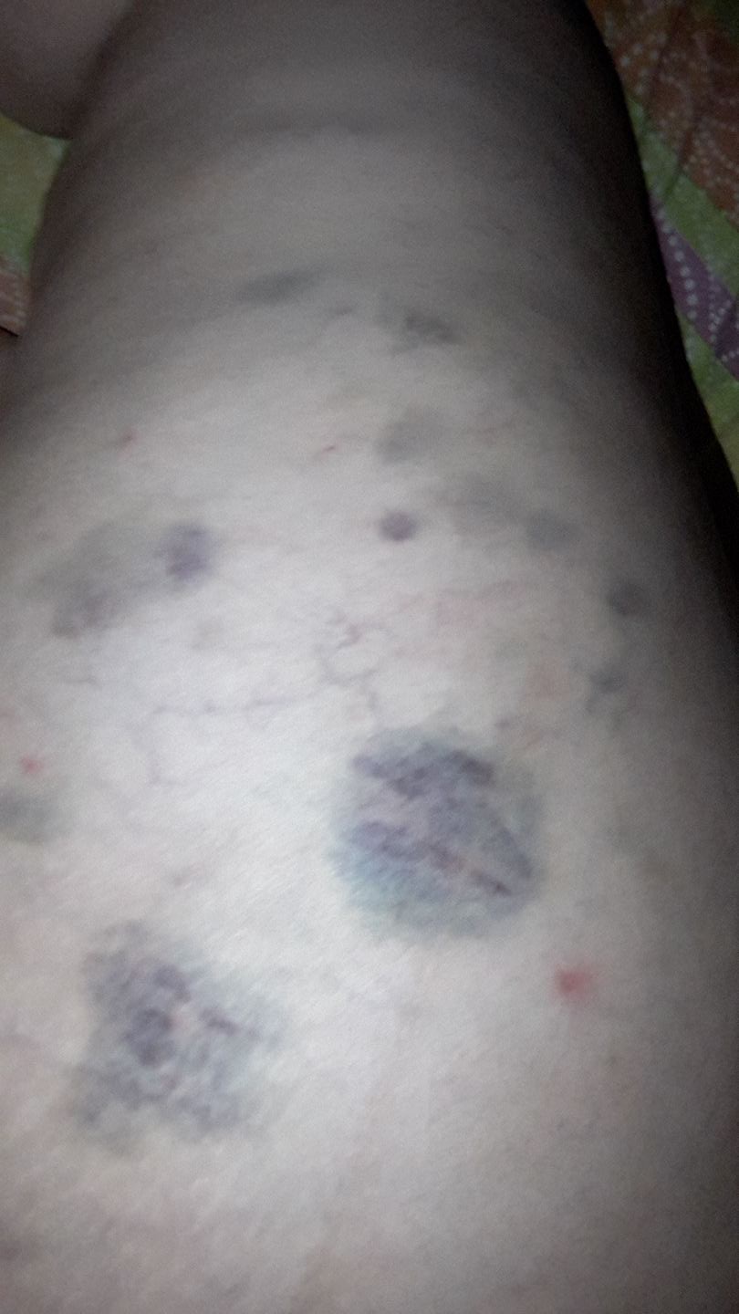 27018660_935960536561157_644402989_o