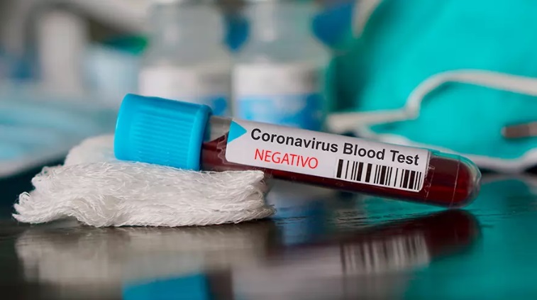 test-coronavirus