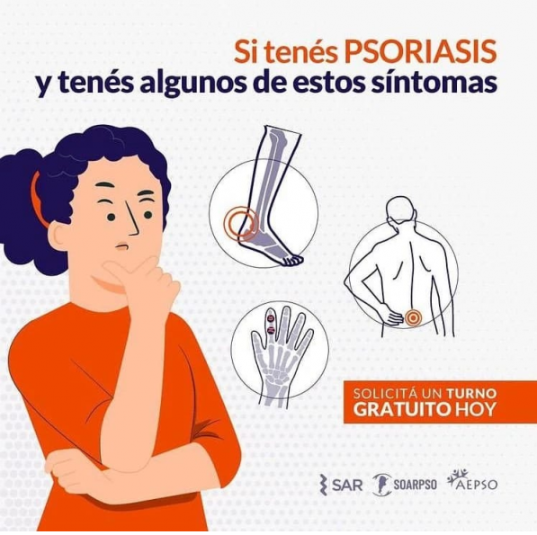 psoriasiss