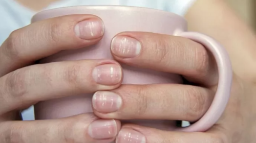 uñas