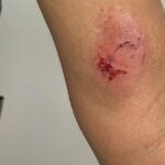 PERGAMINO-Una joven mordió a una policía en un procedimiento